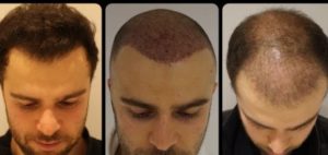 hair transformation 